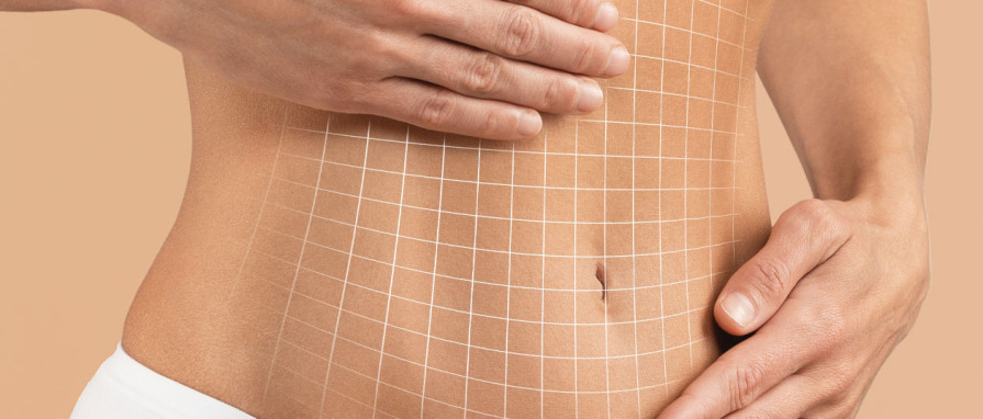 Liposuction Turkey - Burak Pasinlioglu, MD