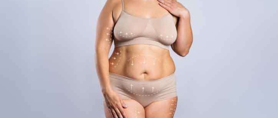 Annelik Estetiği Nedir? Nasıl Yapılır?