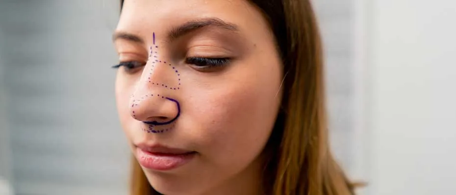 Burun Eğriliği ve Estetik Ameliyatı: Bilmeniz Gereken Her Şey