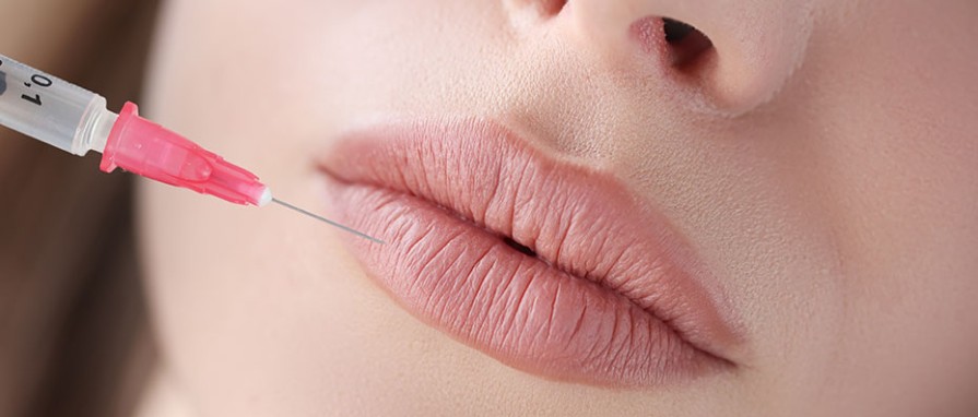 Dudak Dolgusu Estetiği Nedir, Nasıl Yapılır ve Avantajları Nelerdir?