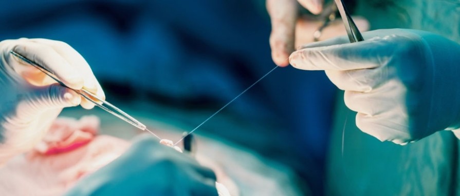 Plastik Cerrahide Dikiş İzi Kalır mı? Estetik Dikişle İzleri Azaltmanın Yolları