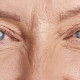 Göz Çevresi Kırışıklıkları İçin En Başarılı Estetik Uygulamalar