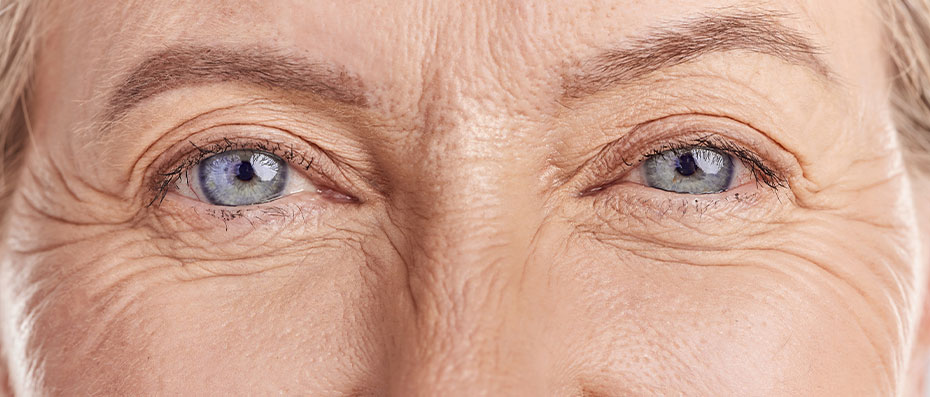 The Most Effective Aesthetic Treatments for Eye Area Wrinkles