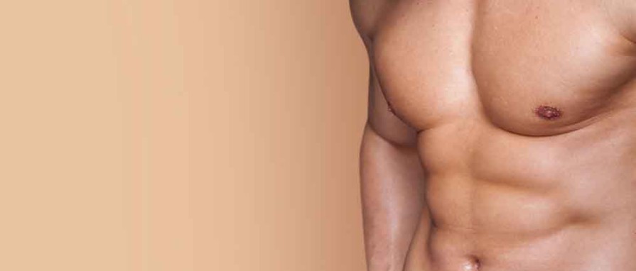 High Definition Liposuction