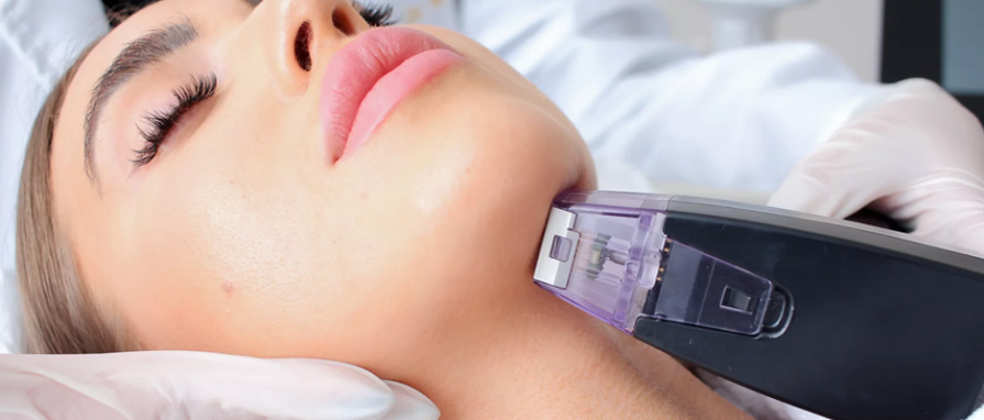 Cildiniz İçin Gençlik İksiri: Morpheus 8 Altın İğne Nedir, Nasıl Uygulanır?