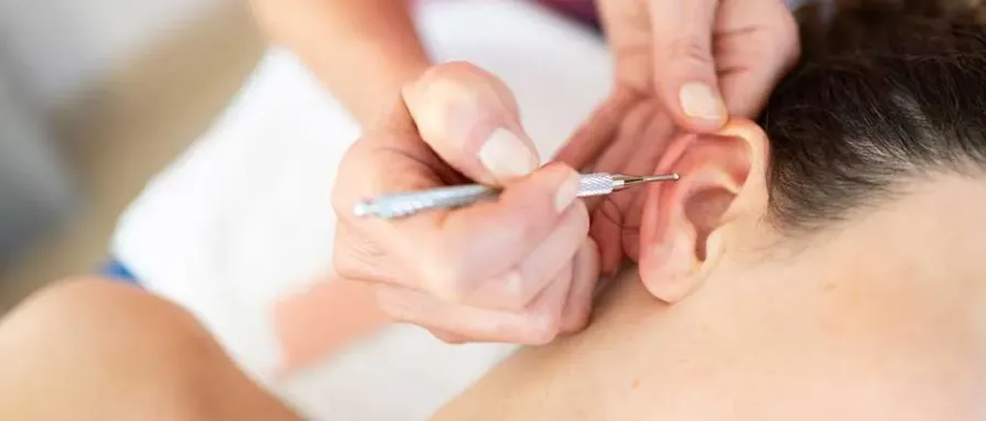 Kulak Estetiği (Otoplasti) Ameliyatında En Yeni Yöntemler