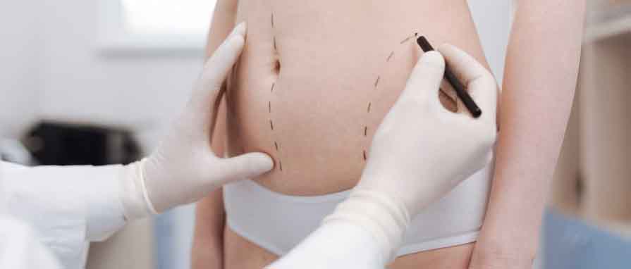 Liposuction: İstenmeyen Yağları Elveda De!