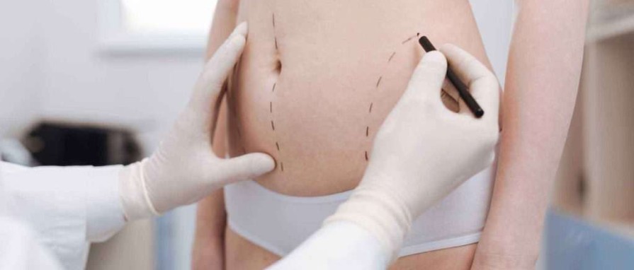 Liposuction: İstenmeyen Yağlara Elveda Deyin