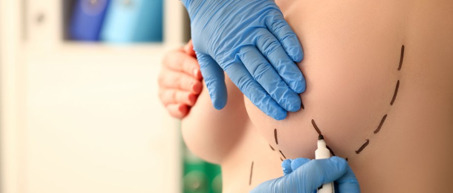 Meme Dikleştirme Sonrası Dikkat Edilmesi Gerekenler