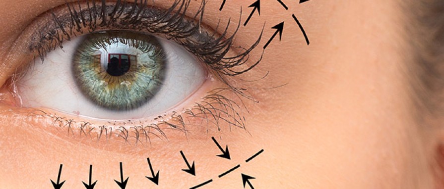 Üst Göz Kapağı Estetiği - Dr. Burak Pasinlioğlu