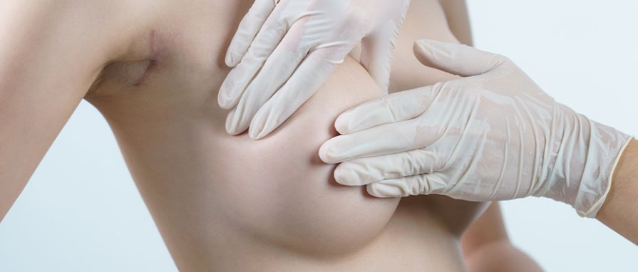 Yağ Enjeksiyonuyla Meme Büyütme Operasyonu ve Sonuçları