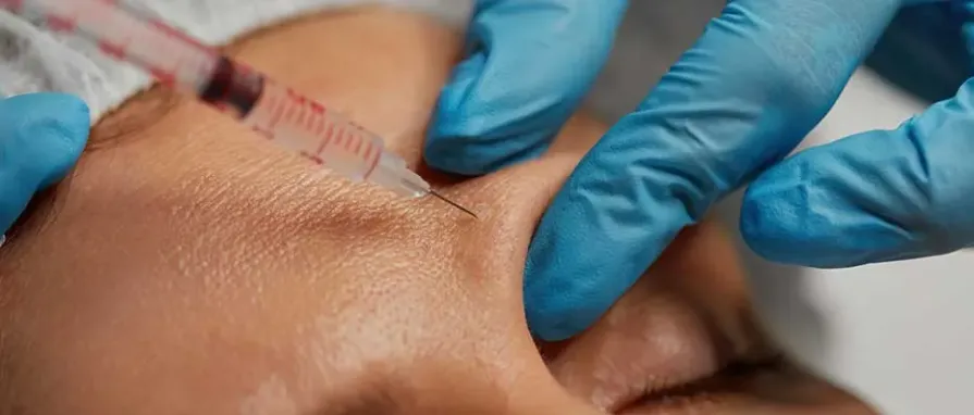 Yüze Yağ Enjeksiyonu ile Doğal Bir Gençleşme Mümkün mü?